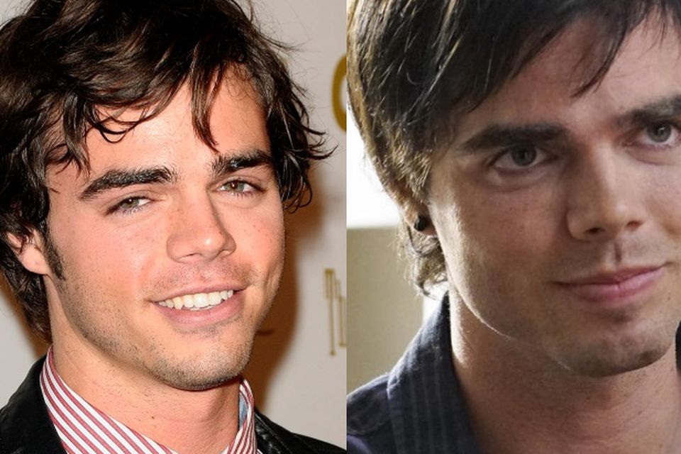 Modern Family star Reid Ewing reveals plastic surgery addiction