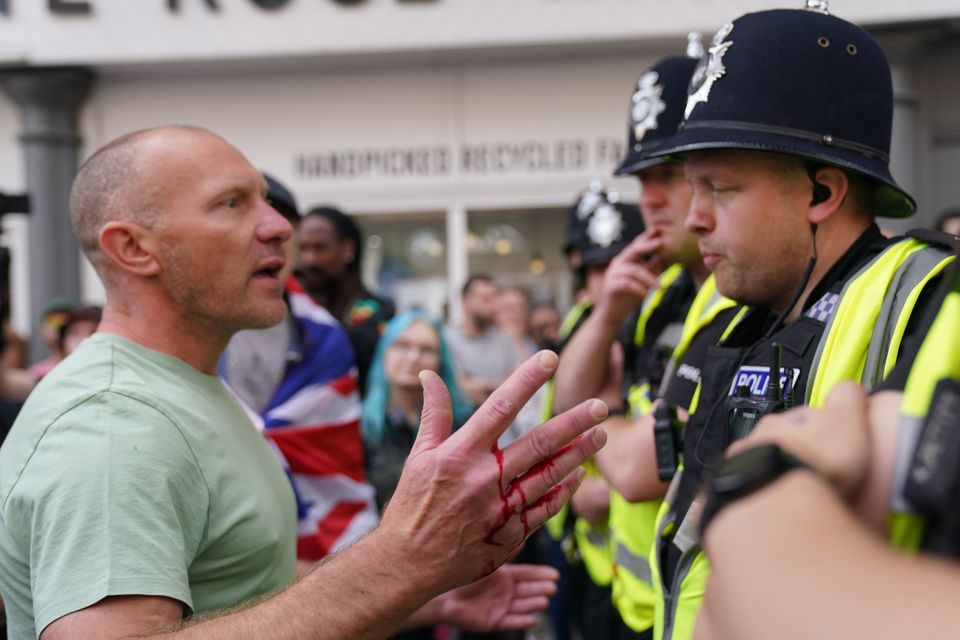 A man with blood on his hand speaks to a police officer during a protest in Nottingham’s Market Square (Jacob King/PA)