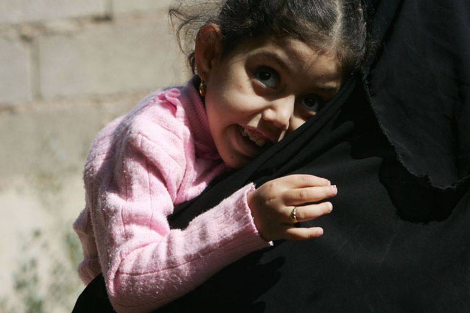 Mariam Yasir (L), age 6 years old, who suffers from a birth defect, cries as her mother carries her on November 12, 2009 in the city of Falluja west of Baghdad, Iraq