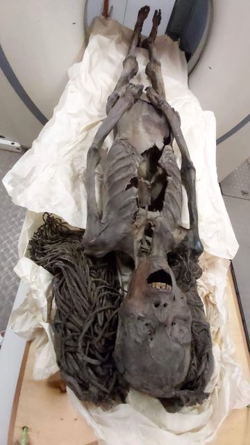 The mummy undergoing a CT scan (Sahar Saleem/Cairo University/PA)