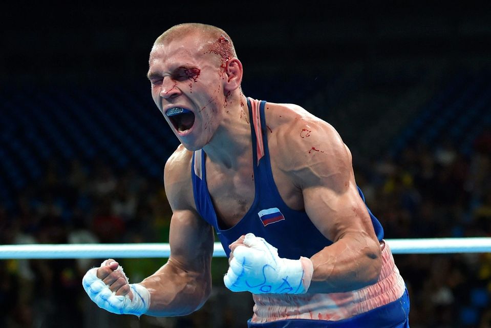 Blood covered Russia's Vladimir Nikitin reacts to winning against Ireland's Michael John Conlan during the Men's Bantam (56kg) Quarterfinal 1 match at the Rio 2016 Olympic Games at the Riocentro - Pavilion 6 in Rio de Janeiro on August 16, 2016. AFP/Getty Images