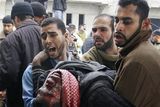 thumbnail: A Palestinian man wounded in an Israeli missile strike is carried into the emergency area at Shifa hospital in Gaza City, Saturday, Dec. 27, 2008. Israeli warplanes demolished dozens of Hamas security compounds across Gaza on Saturday in unprecedented waves of simultaneous air strikes. Gaza medics said more than 120 people were killed and more than 250 wounded.(AP Photo/Hatem Moussa)