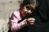 thumbnail: Mariam Yasir (L), age 6 years old, who suffers from a birth defect, cries as her mother carries her on November 12, 2009 in the city of Falluja west of Baghdad, Iraq