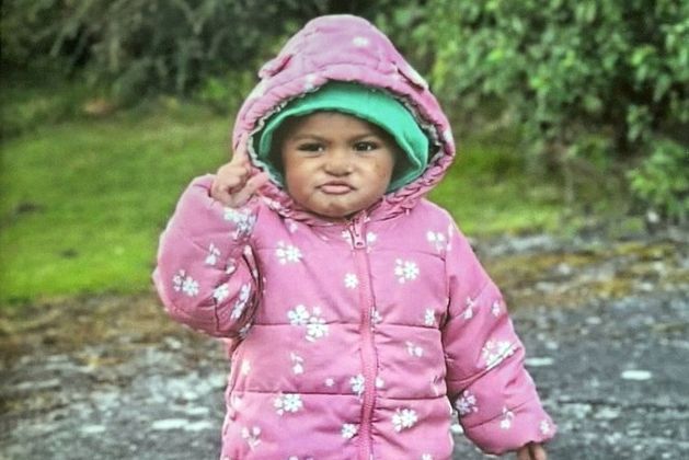 A toddler murdered in Co Tyrone had bruising on her head and face, as well as grip marks on her arm and signs of scalding on her ear, a court has heard.