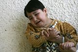 thumbnail: Zahra Muhammad, age 4 years old, who suffers from a birth defect is held by her father on November 12, 2009 in the city of Falluja west of Baghdad, Iraq