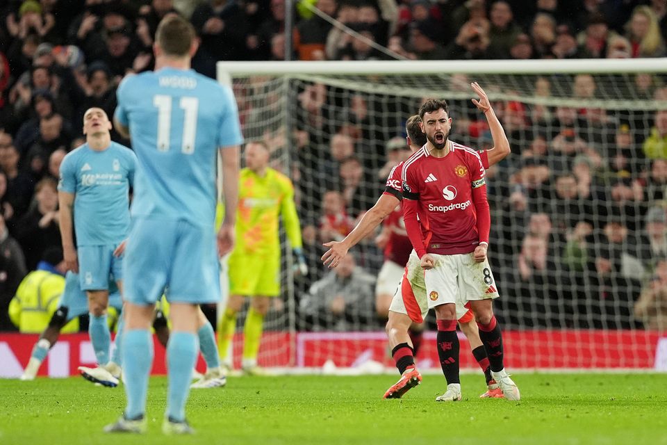 Manchester United have suffered back-to-back defeats (Martin Rickett/PA)