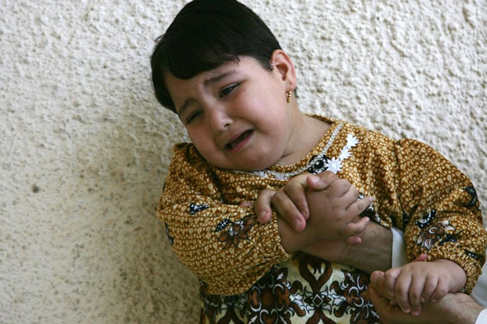 Zahra Muhammad, age 4 years old, who suffers from a birth defect is held by her father on November 12, 2009 in the city of Falluja west of Baghdad, Iraq