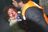 thumbnail: A child arrives at Shifa hospital in Gaza City after an Israeli air strike yesterday
