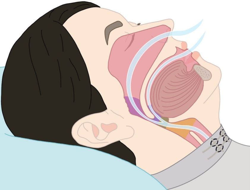 The monitoring of sleep behaviour begins by detecting subtle vibrations at the extrinsic laryngeal muscle (Cambridge University/PA)