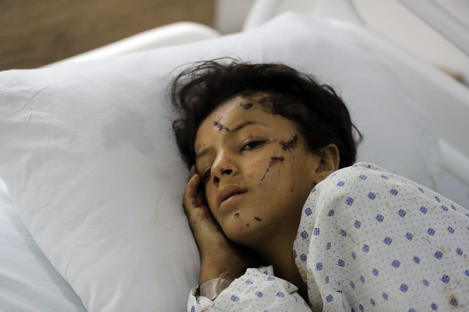 A wounded girl lies in a hospital bed in the southern village of Saksakieh, Lebanon (Mohammed Zaatari/AP)