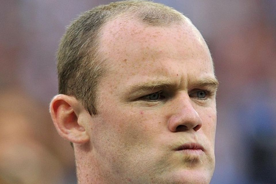 Wayne Rooney admits hair transplant 