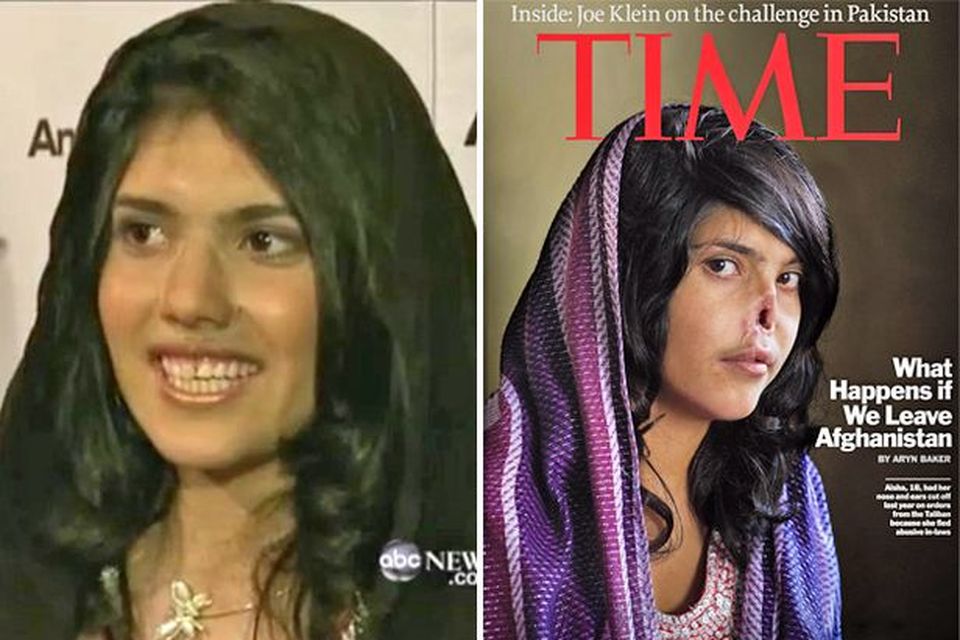 Aisha, left, after her reconstructive surgery; on the cover of Time magazine in August