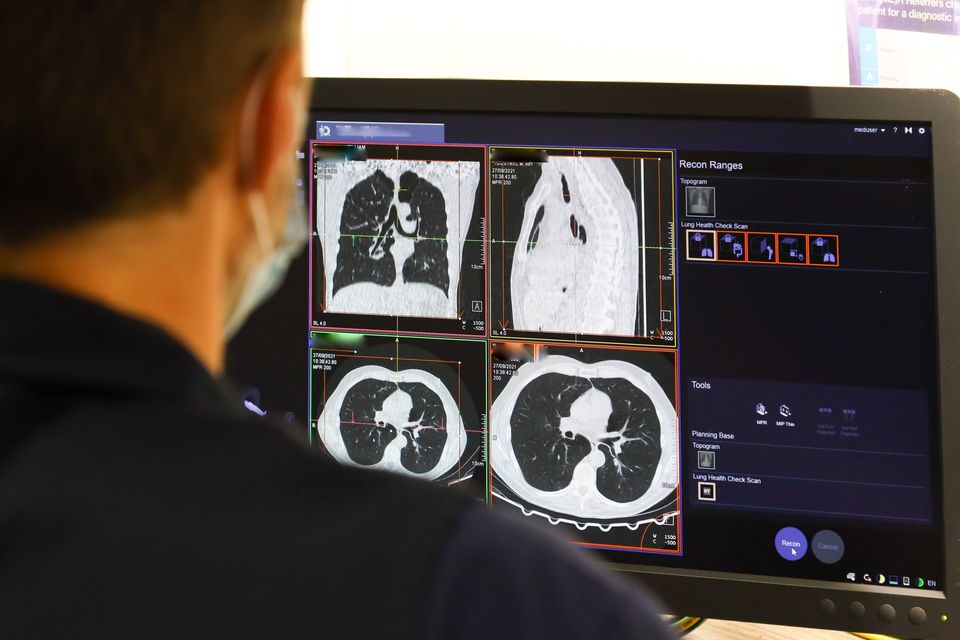 An NHS worker looks at the results of a lung scan, part of the NHS Targeted Lung Health Check Programme (NHS/PA)