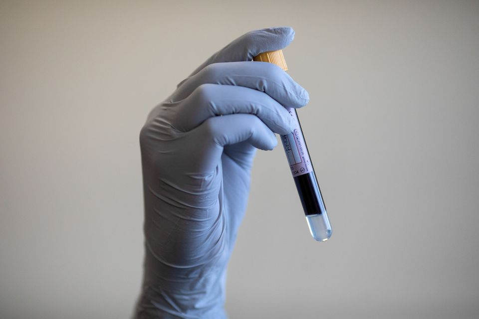 There is also the possibility for blood tests to be created to diagnose autoimmune conditions (PA)