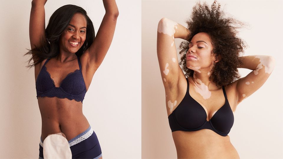 Aerie's New Campaign Featuring Models With Disabilities and Illnesses