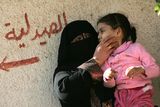 thumbnail: Mariam Yasir, age 6 years old, who suffers from a birth defect is held by her mother in the city of Falluja west of Baghdad, Iraq