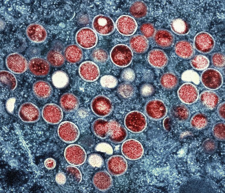 An electron micrograph of monkeypox particles found within an infected cell (NIAID via AP)