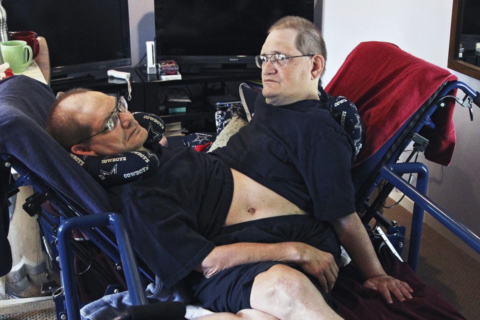 Brother pays tribute after death of world’s longest-surviving conjoined ...