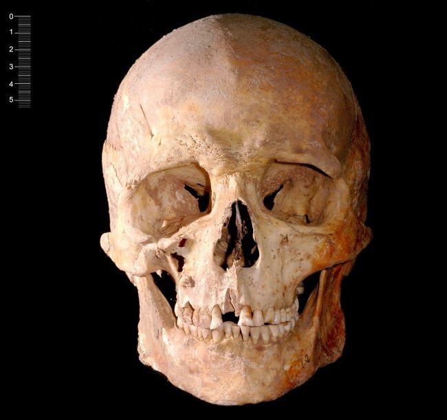 Mesolithic man reveals origins of blue eyes, lactose intolerance