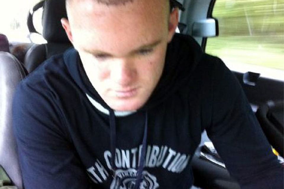 Manchester United star Wayne Rooney shows off hair transplant results |  
