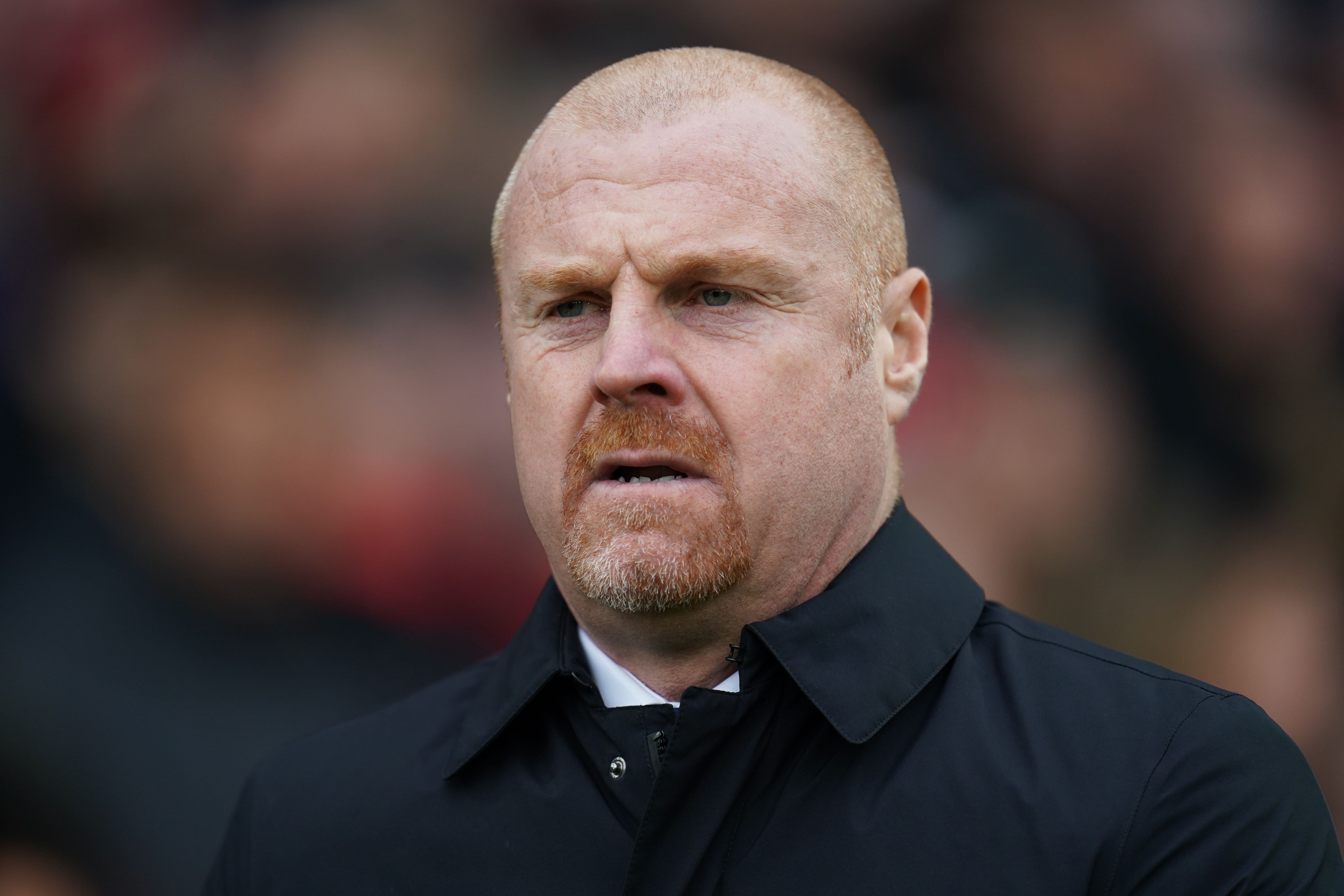 Everton Manager Sean Dyche Attacks Culture Of Players Exaggerating ...